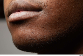 HD Face Skin Kavan chin face lips mouth skin pores…